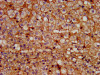 IHC image of CSB-PA018746LA01HU diluted at 1:200 and staining in paraffin-embedded human adrenal gland tissue performed on a Leica BondTM system. After dewaxing and hydration, antigen retrieval was mediated by high pressure in a citrate buffer (pH 6.0) . Section was blocked with 10% normal goat serum 30min at RT. Then primary antibody (1% BSA) was incubated at 4°C overnight. The primary is detected by a biotinylated secondary antibody and visualized using an HRP conjugated SP system.