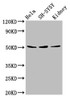 Western Blot<br />
 Positive WB detected in: Hela whole cell lysate, SH-SY5Y whole cell lysate, Mouse kidney tissue<br />
 All lanes: RARG antibody at 8µg/ml<br />
 Secondary<br />
 Goat polyclonal to rabbit IgG at 1/50000 dilution<br />
 Predicted band size: 51, 50, 43, 48 kDa<br />
 Observed band size: 51 kDa<br />