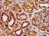 IHC image of CSB-PA22689A0Rb diluted at 1:500 and staining in paraffin-embedded human kidney tissue performed on a Leica BondTM system. After dewaxing and hydration, antigen retrieval was mediated by high pressure in a citrate buffer (pH 6.0) . Section was blocked with 10% normal goat serum 30min at RT. Then primary antibody (1% BSA) was incubated at 4°C overnight. The primary is detected by a biotinylated secondary antibody and visualized using an HRP conjugated SP system.