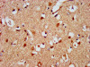 IHC image of CSB-PA22689A0Rb diluted at 1:500 and staining in paraffin-embedded human brain tissue performed on a Leica BondTM system. After dewaxing and hydration, antigen retrieval was mediated by high pressure in a citrate buffer (pH 6.0) . Section was blocked with 10% normal goat serum 30min at RT. Then primary antibody (1% BSA) was incubated at 4°C overnight. The primary is detected by a biotinylated secondary antibody and visualized using an HRP conjugated SP system.