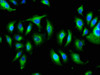 Immunofluorescence staining of A549 cells with CSB-PA22689A0Rb at 1:166, counter-stained with DAPI. The cells were fixed in 4% formaldehyde, permeabilized using 0.2% Triton X-100 and blocked in 10% normal Goat Serum. The cells were then incubated with the antibody overnight at 4°C. The secondary antibody was Alexa Fluor 488-congugated AffiniPure Goat Anti-Rabbit IgG (H+L) .