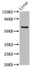 Western Blot<br />
 Positive WB detected in: Mouse liver tissue<br />
 All lanes: NT5C2 antibody at 3µg/ml<br />
 Secondary<br />
 Goat polyclonal to rabbit IgG at 1/50000 dilution<br />
 Predicted band size: 65, 62 kDa<br />
 Observed band size: 65 kDa<br /> Western Blot<br />
 Positive WB detected in: Mouse liver tissue<br />
 All lanes: NT5C2 antibody at 3µg/ml<br />
 Secondary<br />
 Goat polyclonal to rabbit IgG at 1/50000 dilution<br />
 Predicted band size: 65, 62 kDa<br />
 Observed band size: 65 kDa<br />