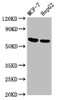 Western Blot<br />
 Positive WB detected in: MCF-7 whole cell lysate, HepG2 whole cell lysate<br />
 All lanes: GNAS antibody at 3.4µg/ml<br />
 Secondary<br />
 Goat polyclonal to rabbit IgG at 1/50000 dilution<br />
 Predicted band size: 68 kDa<br />
 Observed band size: 68 kDa<br />