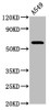 Western Blot<br />
 Positive WB detected in: A549 whole cell lysate<br />
 All lanes: PDE9A antibody at 3.9µg/ml<br />
 Secondary<br />
 Goat polyclonal to rabbit IgG at 1/50000 dilution<br />
 Predicted band size: 69, 62, 55, 63, 58, 46, 59, 51, 45, 54, 65, 66, 57 kDa<br />
 Observed band size: 69 kDa<br />