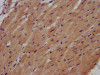 IHC image of CSB-PA600257LA01HU diluted at 1:500 and staining in paraffin-embedded human heart tissue performed on a Leica BondTM system. After dewaxing and hydration, antigen retrieval was mediated by high pressure in a citrate buffer (pH 6.0) . Section was blocked with 10% normal goat serum 30min at RT. Then primary antibody (1% BSA) was incubated at 4°C overnight. The primary is detected by a biotinylated secondary antibody and visualized using an HRP conjugated SP system.