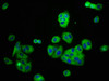 Immunofluorescence staining of HepG2 cells with CSB-PA613604LA01HU at 1:166, counter-stained with DAPI. The cells were fixed in 4% formaldehyde, permeabilized using 0.2% Triton X-100 and blocked in 10% normal Goat Serum. The cells were then incubated with the antibody overnight at 4°C. The secondary antibody was Alexa Fluor 488-congugated AffiniPure Goat Anti-Rabbit IgG (H+L) .