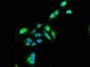Immunofluorescence staining of Hela cells with CSB-PA619959LA01HU at 1:100, counter-stained with DAPI. The cells were fixed in 4% formaldehyde, permeabilized using 0.2% Triton X-100 and blocked in 10% normal Goat Serum. The cells were then incubated with the antibody overnight at 4°C. The secondary antibody was Alexa Fluor 488-congugated AffiniPure Goat Anti-Rabbit IgG (H+L) .
