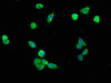 Immunofluorescence staining of SH-SY5Y cells with CSB-PA620971LA01HU at 1:200, counter-stained with DAPI. The cells were fixed in 4% formaldehyde, permeabilized using 0.2% Triton X-100 and blocked in 10% normal Goat Serum. The cells were then incubated with the antibody overnight at 4°C. The secondary antibody was Alexa Fluor 488-congugated AffiniPure Goat Anti-Rabbit IgG (H+L) .