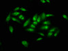 Immunofluorescence staining of Hela cells with CSB-PA626626LA01HU at 1:66, counter-stained with DAPI. The cells were fixed in 4% formaldehyde, permeabilized using 0.2% Triton X-100 and blocked in 10% normal Goat Serum. The cells were then incubated with the antibody overnight at 4°C. The secondary antibody was Alexa Fluor 488-congugated AffiniPure Goat Anti-Rabbit IgG (H+L) .