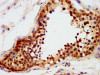 IHC image of CSB-PA652403LA01HU diluted at 1:600 and staining in paraffin-embedded human testis tissue performed on a Leica BondTM system. After dewaxing and hydration, antigen retrieval was mediated by high pressure in a citrate buffer (pH 6.0) . Section was blocked with 10% normal goat serum 30min at RT. Then primary antibody (1% BSA) was incubated at 4°C overnight. The primary is detected by a biotinylated secondary antibody and visualized using an HRP conjugated SP system.