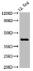 Western Blot<br />
 Positive WB detected in Recombinant protein<br />
 All lanes: ZAR1 antibody at 5.32µg/ml<br />
 Secondary<br />
 Goat polyclonal to rabbit IgG at 1/50000 dilution<br />
 Predicted band size: 42 kDa<br />
 Observed band size: 42 kDa<br />