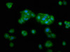 Immunofluorescence staining of HepG2 cells with CSB-PA659468LA01HU at 1:133, counter-stained with DAPI. The cells were fixed in 4% formaldehyde, permeabilized using 0.2% Triton X-100 and blocked in 10% normal Goat Serum. The cells were then incubated with the antibody overnight at 4°C. The secondary antibody was Alexa Fluor 488-congugated AffiniPure Goat Anti-Rabbit IgG (H+L) .