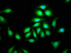 Immunofluorescence staining of A549 cells with CSB-PA721063LA01HU at 1:100, counter-stained with DAPI. The cells were fixed in 4% formaldehyde, permeabilized using 0.2% Triton X-100 and blocked in 10% normal Goat Serum. The cells were then incubated with the antibody overnight at 4°C. The secondary antibody was Alexa Fluor 488-congugated AffiniPure Goat Anti-Rabbit IgG (H+L) .