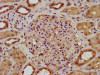 IHC image of CSB-PA733819LA01HU diluted at 1:200 and staining in paraffin-embedded human kidney tissue performed on a Leica BondTM system. After dewaxing and hydration, antigen retrieval was mediated by high pressure in a citrate buffer (pH 6.0) . Section was blocked with 10% normal goat serum 30min at RT. Then primary antibody (1% BSA) was incubated at 4°C overnight. The primary is detected by a biotinylated secondary antibody and visualized using an HRP conjugated SP system.