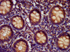 IHC image of CSB-PA744034LA01HU diluted at 1:400 and staining in paraffin-embedded human appendix tissue performed on a Leica BondTM system. After dewaxing and hydration, antigen retrieval was mediated by high pressure in a citrate buffer (pH 6.0) . Section was blocked with 10% normal goat serum 30min at RT. Then primary antibody (1% BSA) was incubated at 4°C overnight. The primary is detected by a biotinylated secondary antibody and visualized using an HRP conjugated SP system.