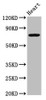 Western Blot<br />
 Positive WB detected in: Rat heart tissue<br />
 All lanes: NLRP10 antibody at 4.9µg/ml<br />
 Secondary<br />
 Goat polyclonal to rabbit IgG at 1/50000 dilution<br />
 Predicted band size: 76 kDa<br />
 Observed band size: 76 kDa<br />