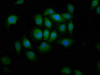 Immunofluorescence staining of A549 cells with CSB-PA774804LA01HU at 1:166, counter-stained with DAPI. The cells were fixed in 4% formaldehyde, permeabilized using 0.2% Triton X-100 and blocked in 10% normal Goat Serum. The cells were then incubated with the antibody overnight at 4°C. The secondary antibody was Alexa Fluor 488-congugated AffiniPure Goat Anti-Rabbit IgG (H+L) .