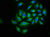 Immunofluorescence staining of A549 cells with CSB-PA804482LA01HU at 1:166, counter-stained with DAPI. The cells were fixed in 4% formaldehyde, permeabilized using 0.2% Triton X-100 and blocked in 10% normal Goat Serum. The cells were then incubated with the antibody overnight at 4°C. The secondary antibody was Alexa Fluor 488-congugated AffiniPure Goat Anti-Rabbit IgG (H+L) .