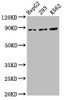 Western Blot<br />
 Positive WB detected in: HepG2 whole cell lysate, 293 whole cell lysate, K562 whole cell lysate<br />
 All lanes: CDH7 antibody at 5.5µg/ml<br />
 Secondary<br />
 Goat polyclonal to rabbit IgG at 1/50000 dilution<br />
 Predicted band size: 88 kDa<br />
 Observed band size: 88 kDa<br />