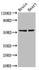 Western Blot<br />
 Positive WB detected in: Rat brain tisseu, Rat heart tissue<br />
 All lanes: RBM45 antibody at 12µg/ml<br />
 Secondary<br />
 Goat polyclonal to rabbit IgG at 1/50000 dilution<br />
 Predicted band size: 54, 38 kDa<br />
 Observed band size: 54 kDa<br />