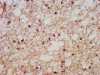 IHC image of CSB-PA818264LA01HU diluted at 1:600 and staining in paraffin-embedded human brain tissue performed on a Leica BondTM system. After dewaxing and hydration, antigen retrieval was mediated by high pressure in a citrate buffer (pH 6.0) . Section was blocked with 10% normal goat serum 30min at RT. Then primary antibody (1% BSA) was incubated at 4°C overnight. The primary is detected by a biotinylated secondary antibody and visualized using an HRP conjugated SP system.