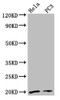 Western Blot<br />
 Positive WB detected in: Hela whole cell lysate, PC-3 whole cell lysate<br />
 All lanes: NDUFAF2 antibody at 2.7µg/ml<br />
 Secondary<br />
 Goat polyclonal to rabbit IgG at 1/50000 dilution<br />
 Predicted band size: 20 kDa<br />
 Observed band size: 20 kDa<br /> Western Blot<br />
 Positive WB detected in: Hela whole cell lysate, PC-3 whole cell lysate<br />
 All lanes: NDUFAF2 antibody at 2.7µg/ml<br />
 Secondary<br />
 Goat polyclonal to rabbit IgG at 1/50000 dilution<br />
 Predicted band size: 20 kDa<br />
 Observed band size: 20 kDa<br />
