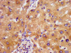 IHC image of CSB-PA836643LA01HU diluted at 1:500 and staining in paraffin-embedded human liver tissue performed on a Leica BondTM system. After dewaxing and hydration, antigen retrieval was mediated by high pressure in a citrate buffer (pH 6.0) . Section was blocked with 10% normal goat serum 30min at RT. Then primary antibody (1% BSA) was incubated at 4°C overnight. The primary is detected by a biotinylated secondary antibody and visualized using an HRP conjugated SP system. IHC image of CSB-PA836643LA01HU diluted at 1:500 and staining in paraffin-embedded human liver tissue performed on a Leica BondTM system. After dewaxing and hydration, antigen retrieval was mediated by high pressure in a citrate buffer (pH 6.0) . Section was blocked with 10% normal goat serum 30min at RT. Then primary antibody (1% BSA) was incubated at 4°C overnight. The primary is detected by a biotinylated secondary antibody and visualized using an HRP conjugated SP system.