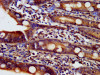 IHC image of CSB-PA836643LA01HU diluted at 1:500 and staining in paraffin-embedded human small intestine tissue performed on a Leica BondTM system. After dewaxing and hydration, antigen retrieval was mediated by high pressure in a citrate buffer (pH 6.0) . Section was blocked with 10% normal goat serum 30min at RT. Then primary antibody (1% BSA) was incubated at 4°C overnight. The primary is detected by a biotinylated secondary antibody and visualized using an HRP conjugated SP system. IHC image of CSB-PA836643LA01HU diluted at 1:500 and staining in paraffin-embedded human small intestine tissue performed on a Leica BondTM system. After dewaxing and hydration, antigen retrieval was mediated by high pressure in a citrate buffer (pH 6.0) . Section was blocked with 10% normal goat serum 30min at RT. Then primary antibody (1% BSA) was incubated at 4°C overnight. The primary is detected by a biotinylated secondary antibody and visualized using an HRP conjugated SP system.