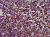 IHC image of CSB-PA846589LA01HU diluted at 1:200 and staining in paraffin-embedded human lymph node tissue performed on a Leica BondTM system. After dewaxing and hydration, antigen retrieval was mediated by high pressure in a citrate buffer (pH 6.0) . Section was blocked with 10% normal goat serum 30min at RT. Then primary antibody (1% BSA) was incubated at 4°C overnight. The primary is detected by a biotinylated secondary antibody and visualized using an HRP conjugated SP system.
