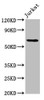 Western Blot<br />
 Positive WB detected in: Jurkat whole cell lysate<br />
 All lanes: SLAIN1 antibody at 4.2µg/ml<br />
 Secondary<br />
 Goat polyclonal to rabbit IgG at 1/50000 dilution<br />
 Predicted band size: 61, 34, 21, 48 kDa<br />
 Observed band size: 61 kDa<br />