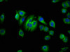 Immunofluorescence staining of A549 cells with CSB-PA853482LA01HU at 1:66, counter-stained with DAPI. The cells were fixed in 4% formaldehyde, permeabilized using 0.2% Triton X-100 and blocked in 10% normal Goat Serum. The cells were then incubated with the antibody overnight at 4°C. The secondary antibody was Alexa Fluor 488-congugated AffiniPure Goat Anti-Rabbit IgG (H+L) .