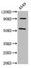 Western Blot<br />
 Positive WB detected in: A549 whole cell lysate<br />
 All lanes: LEMD2 antibody at 6.95µg/ml<br />
 Secondary<br />
 Goat polyclonal to rabbit IgG at 1/50000 dilution<br />
 Predicted band size: 57, 24 kDa<br />
 Observed band size: 57 kDa<br />