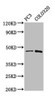 Western Blot<br />
 Positive WB detected in: PC-3 whole cell lysate, Colo320 whole cell lysate<br />
 All lanes: CAPS2 antibody at 5.2µg/ml<br />
 Secondary<br />
 Goat polyclonal to rabbit IgG at 1/50000 dilution<br />
 Predicted band size: 64, 45, 34 kDa<br />
 Observed band size: 45 kDa<br />