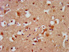 IHC image of CSB-PA861167LA01HU diluted at 1:500 and staining in paraffin-embedded human brain tissue performed on a Leica BondTM system. After dewaxing and hydration, antigen retrieval was mediated by high pressure in a citrate buffer (pH 6.0) . Section was blocked with 10% normal goat serum 30min at RT. Then primary antibody (1% BSA) was incubated at 4°C overnight. The primary is detected by a biotinylated secondary antibody and visualized using an HRP conjugated SP system.