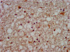 IHC image of CSB-PA863965LA01HU diluted at 1:500 and staining in paraffin-embedded human brain tissue performed on a Leica BondTM system. After dewaxing and hydration, antigen retrieval was mediated by high pressure in a citrate buffer (pH 6.0) . Section was blocked with 10% normal goat serum 30min at RT. Then primary antibody (1% BSA) was incubated at 4°C overnight. The primary is detected by a biotinylated secondary antibody and visualized using an HRP conjugated SP system.