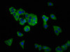 Immunofluorescence staining of HepG2 cells with CSB-PA863965LA01HU at 1:166, counter-stained with DAPI. The cells were fixed in 4% formaldehyde, permeabilized using 0.2% Triton X-100 and blocked in 10% normal Goat Serum. The cells were then incubated with the antibody overnight at 4°C. The secondary antibody was Alexa Fluor 488-congugated AffiniPure Goat Anti-Rabbit IgG (H+L) .