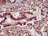 IHC image of CSB-PA865101LA01HU diluted at 1:400 and staining in paraffin-embedded human lung tissue performed on a Leica BondTM system. After dewaxing and hydration, antigen retrieval was mediated by high pressure in a citrate buffer (pH 6.0) . Section was blocked with 10% normal goat serum 30min at RT. Then primary antibody (1% BSA) was incubated at 4°C overnight. The primary is detected by a biotinylated secondary antibody and visualized using an HRP conjugated SP system.