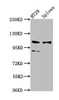 Western Blot<br />
 Positive WB detected in: HT29 whole cell lysate, Rat spleen tissue<br />
 All lanes: SCUBE2 antibody at 8.7µg/ml<br />
 Secondary<br />
 Goat polyclonal to rabbit IgG at 1/50000 dilution<br />
 Predicted band size: 110, 107, 89 kDa<br />
 Observed band size: 110, 89 kDa<br />