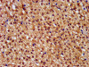 IHC image of CSB-PA868272LA01HU diluted at 1:400 and staining in paraffin-embedded human adrenal gland tissue performed on a Leica BondTM system. After dewaxing and hydration, antigen retrieval was mediated by high pressure in a citrate buffer (pH 6.0) . Section was blocked with 10% normal goat serum 30min at RT. Then primary antibody (1% BSA) was incubated at 4°C overnight. The primary is detected by a biotinylated secondary antibody and visualized using an HRP conjugated SP system.