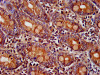 IHC image of CSB-PA868272LA01HU diluted at 1:400 and staining in paraffin-embedded human small intestine tissue performed on a Leica BondTM system. After dewaxing and hydration, antigen retrieval was mediated by high pressure in a citrate buffer (pH 6.0) . Section was blocked with 10% normal goat serum 30min at RT. Then primary antibody (1% BSA) was incubated at 4°C overnight. The primary is detected by a biotinylated secondary antibody and visualized using an HRP conjugated SP system. IHC image of CSB-PA868272LA01HU diluted at 1:400 and staining in paraffin-embedded human small intestine tissue performed on a Leica BondTM system. After dewaxing and hydration, antigen retrieval was mediated by high pressure in a citrate buffer (pH 6.0) . Section was blocked with 10% normal goat serum 30min at RT. Then primary antibody (1% BSA) was incubated at 4°C overnight. The primary is detected by a biotinylated secondary antibody and visualized using an HRP conjugated SP system.