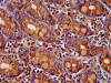 IHC image of CSB-PA868272LA01HU diluted at 1:400 and staining in paraffin-embedded human small intestine tissue performed on a Leica BondTM system. After dewaxing and hydration, antigen retrieval was mediated by high pressure in a citrate buffer (pH 6.0) . Section was blocked with 10% normal goat serum 30min at RT. Then primary antibody (1% BSA) was incubated at 4°C overnight. The primary is detected by a biotinylated secondary antibody and visualized using an HRP conjugated SP system.