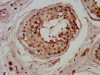 IHC image of CSB-PA881032LA01HU diluted at 1:200 and staining in paraffin-embedded human testis tissue performed on a Leica BondTM system. After dewaxing and hydration, antigen retrieval was mediated by high pressure in a citrate buffer (pH 6.0) . Section was blocked with 10% normal goat serum 30min at RT. Then primary antibody (1% BSA) was incubated at 4°C overnight. The primary is detected by a biotinylated secondary antibody and visualized using an HRP conjugated SP system.