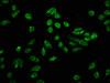 Immunofluorescence staining of Hela cells with CSB-PA010418OA80phHU at 1:10, counter-stained with DAPI. The cells were fixed in 4% formaldehyde, permeabilized using 0.2% Triton X-100 and blocked in 10% normal Goat Serum. The cells were then incubated with the antibody overnight at 4°C. The secondary antibody was Alexa Fluor 488-congugated AffiniPure Goat Anti-Rabbit IgG (H+L) .
