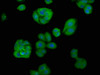 Immunofluorescence staining of HepG2 cells with CSB-PA001919LA01HU at 1:66, counter-stained with DAPI. The cells were fixed in 4% formaldehyde, permeabilized using 0.2% Triton X-100 and blocked in 10% normal Goat Serum. The cells were then incubated with the antibody overnight at 4°C. The secondary antibody was Alexa Fluor 488-congugated AffiniPure Goat Anti-Rabbit IgG (H+L) . Immunofluorescence staining of HepG2 cells with CSB-PA001919LA01HU at 1:66, counter-stained with DAPI. The cells were fixed in 4% formaldehyde, permeabilized using 0.2% Triton X-100 and blocked in 10% normal Goat Serum. The cells were then incubated with the antibody overnight at 4°C. The secondary antibody was Alexa Fluor 488-congugated AffiniPure Goat Anti-Rabbit IgG (H+L) .