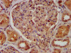 IHC image of CSB-PA004390LA01HU diluted at 1:400 and staining in paraffin-embedded human kidney tissue performed on a Leica BondTM system. After dewaxing and hydration, antigen retrieval was mediated by high pressure in a citrate buffer (pH 6.0) . Section was blocked with 10% normal goat serum 30min at RT. Then primary antibody (1% BSA) was incubated at 4°C overnight. The primary is detected by a biotinylated secondary antibody and visualized using an HRP conjugated SP system.