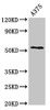 Western Blot<br />
 Positive WB detected in: A375 whole cell lysate<br />
 All lanes: CPE antibody at 2.7µg/ml<br />
 Secondary<br />
 Goat polyclonal to rabbit IgG at 1/50000 dilution<br />
 Predicted band size: 54, 50 kDa<br />
 Observed band size: 54 kDa<br />