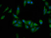 Immunofluorescence staining of Hela cells with CSB-PA007747LA01HU at 1:200, counter-stained with DAPI. The cells were fixed in 4% formaldehyde, permeabilized using 0.2% Triton X-100 and blocked in 10% normal Goat Serum. The cells were then incubated with the antibody overnight at 4°C. The secondary antibody was Alexa Fluor 488-congugated AffiniPure Goat Anti-Rabbit IgG (H+L) .