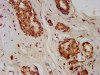 IHC image of CSB-PA009569LA01HU diluted at 1:400 and staining in paraffin-embedded human breast cancer performed on a Leica BondTM system. After dewaxing and hydration, antigen retrieval was mediated by high pressure in a citrate buffer (pH 6.0) . Section was blocked with 10% normal goat serum 30min at RT. Then primary antibody (1% BSA) was incubated at 4°C overnight. The primary is detected by a biotinylated secondary antibody and visualized using an HRP conjugated SP system.