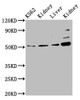 Western Blot<br />
 Positive WB detected in: K562 whole cell lysate, Rat kidney tissue, Mouse liver tissue, Mouse kidney tissue<br />
 All lanes: GSS antibody at 5.1µg/ml<br />
 Secondary<br />
 Goat polyclonal to rabbit IgG at 1/50000 dilution<br />
 Predicted band size: 53, 41 kDa<br />
 Observed band size: 53 kDa<br />