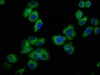 Immunofluorescence staining of A549 cells with CSB-PA012058LA01HU at 1:100, counter-stained with DAPI. The cells were fixed in 4% formaldehyde, permeabilized using 0.2% Triton X-100 and blocked in 10% normal Goat Serum. The cells were then incubated with the antibody overnight at 4°C. The secondary antibody was Alexa Fluor 488-congugated AffiniPure Goat Anti-Rabbit IgG (H+L) .